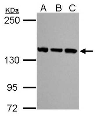 Western Blot: SMC3 Antibody [NBP2-20418]