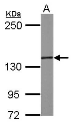 Western Blot: SMC3 Antibody [NBP2-20418]