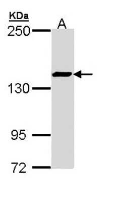 Western Blot: SMC3 Antibody [NBP2-20418]