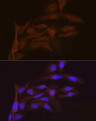Immunocytochemistry/ Immunofluorescence: SMC4 Antibody (9Z8S3) [NBP3-16219]