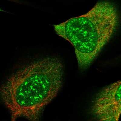 Immunocytochemistry/ Immunofluorescence: SMC4 Antibody [NBP1-86635]