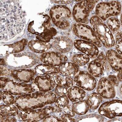 Immunohistochemistry-Paraffin: SMC4 Antibody [NBP1-86635]