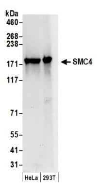 Western Blot: SMC4 Antibody [NB100-374]