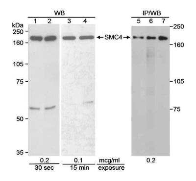 Western Blot: SMC4 Antibody [NB100-375]