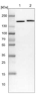 Western Blot: SMC4 Antibody [NBP1-86635]