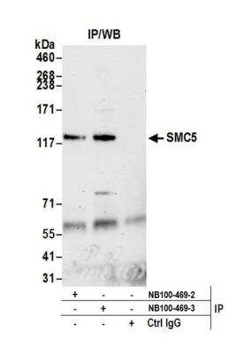 Immunoprecipitation: SMC5 Antibody [NB100-469]
