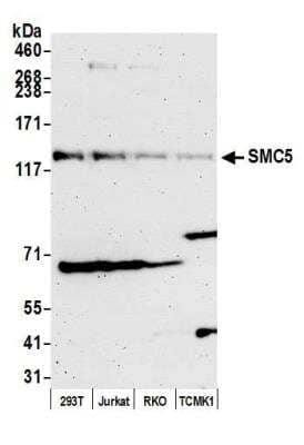 Western Blot: SMC5 Antibody [NB100-469]