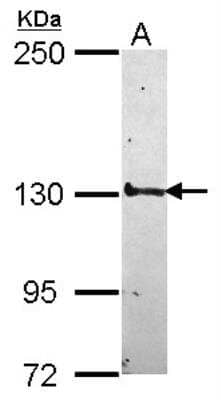 Western Blot: SMC5 Antibody [NBP2-20419]