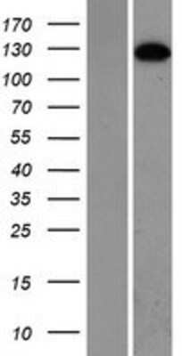 Western Blot: SMC5 Overexpression Lysate [NBP2-07214]