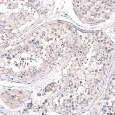 Immunohistochemistry-Paraffin: SMC6L1 Antibody [NBP2-33378]