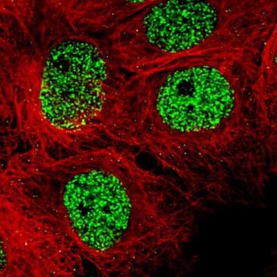 Immunocytochemistry/ Immunofluorescence: SMCHD1 Antibody (CL4265) [NBP2-59045]
