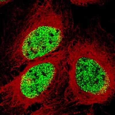 Immunocytochemistry/ Immunofluorescence: SMCHD1 Antibody (CL4265) [NBP2-59045]