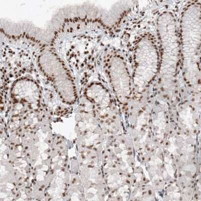 Immunohistochemistry-Paraffin: SMCHD1 Antibody (CL4265) [NBP2-59045]