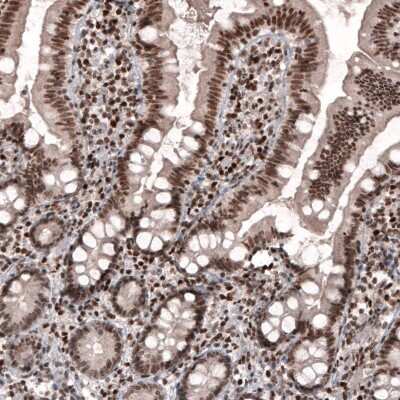 Immunohistochemistry: SMCHD1 Antibody (CL4270) [NBP2-59046]