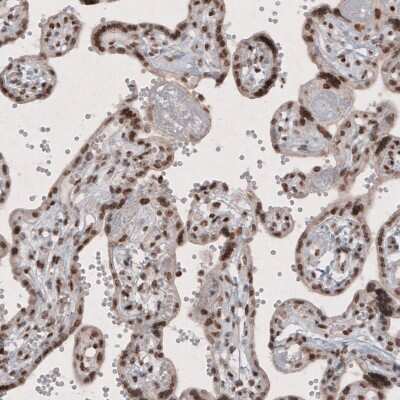 Immunohistochemistry: SMCHD1 Antibody (CL4270) [NBP2-59046]