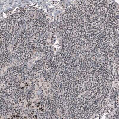 Immunohistochemistry: SMCHD1 Antibody (CL4270) [NBP2-59046]