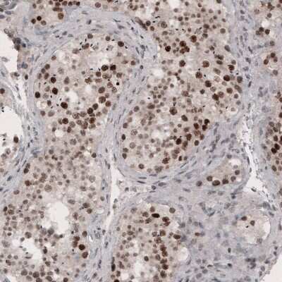 Immunohistochemistry-Paraffin: SMCHD1 Antibody (CL4270) [NBP2-59046]