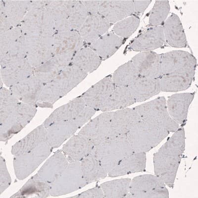 Immunohistochemistry-Paraffin: SMCHD1 Antibody (CL4270) [NBP2-59046]