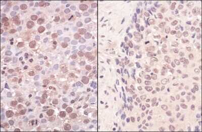 Immunohistochemistry-Paraffin: SMCHD1 Antibody [NBP1-49968]