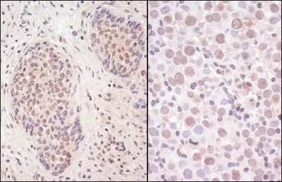 Immunohistochemistry: SMCHD1 Antibody [NBP1-49969]
