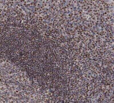 Immunohistochemistry-Paraffin: SMCHD1 Antibody [NBP1-82978]