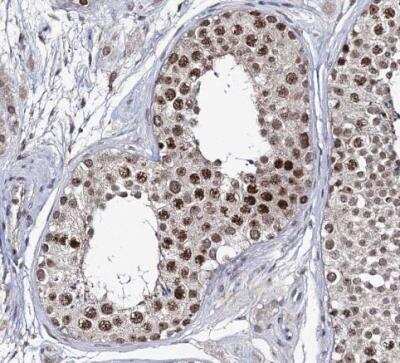Immunohistochemistry-Paraffin: SMCHD1 Antibody [NBP1-82978]