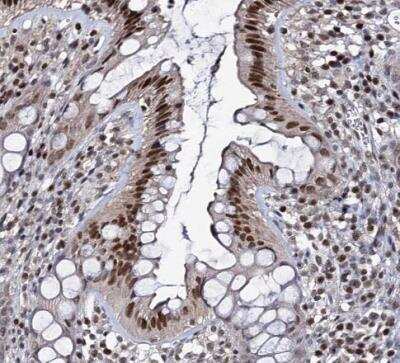 Immunohistochemistry-Paraffin: SMCHD1 Antibody [NBP1-82978]