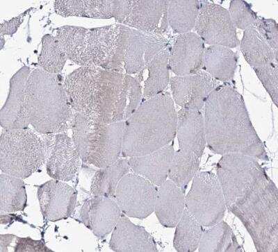 Immunohistochemistry-Paraffin: SMCHD1 Antibody [NBP1-82978]
