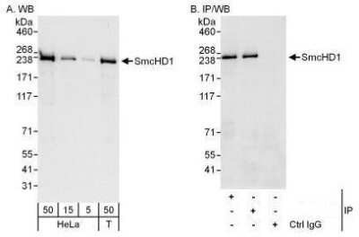 Western Blot: SMCHD1 Antibody [NBP1-49968]