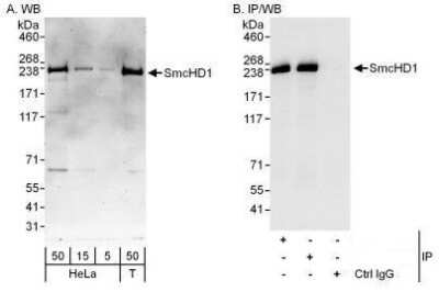 Western Blot: SMCHD1 Antibody [NBP1-49969]