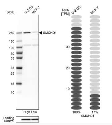 Western Blot: SMCHD1 Antibody [NBP1-82978]