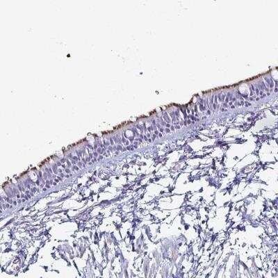 Immunohistochemistry-Paraffin: SMCO1 Antibody [NBP2-32354]