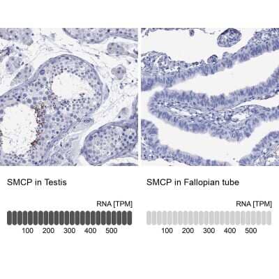 Immunocytochemistry/ Immunofluorescence: SMCP Antibody [NBP3-17066]