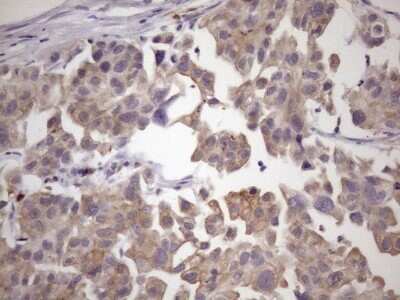 Immunohistochemistry: SMCP Antibody (OTI6G9) - Azide and BSA Free [NBP2-74239]