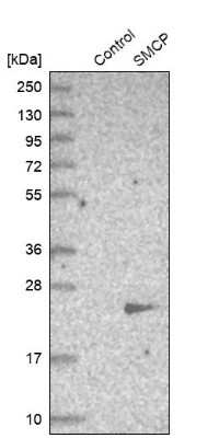 Western Blot: SMCP Antibody [NBP1-81252]