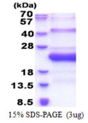 SDS-PAGE: Recombinant Human SMCP His Protein [NBP2-22819]