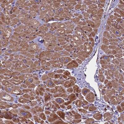 Immunohistochemistry-Paraffin: SMCR7 Antibody [NBP1-81165]