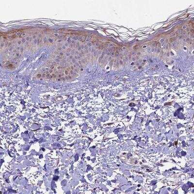 Immunohistochemistry-Paraffin: SMCR7 Antibody [NBP1-81165]