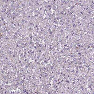Immunohistochemistry-Paraffin: SMCR7 Antibody [NBP1-81165]