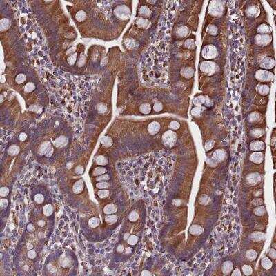 Immunohistochemistry-Paraffin: SMCR7 Antibody [NBP1-81165]