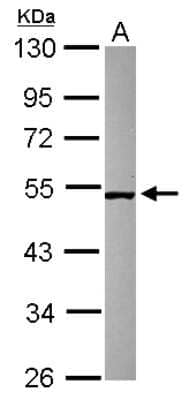 Western Blot: SMCR7 Antibody [NBP2-20421]
