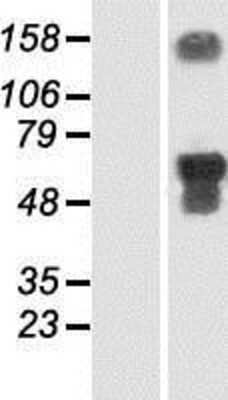 Western Blot: SMCR7 Overexpression Lysate [NBP2-05587]