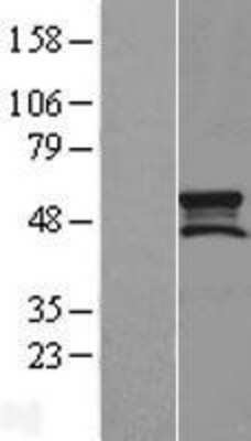 Western Blot: SMCR7L Overexpression Lysate [NBL1-16240]