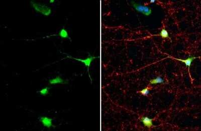 Immunocytochemistry/ Immunofluorescence: SMCR8 Antibody (HL1007) [NBP3-13677]