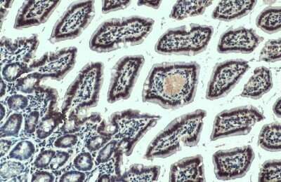 Immunohistochemistry-Paraffin: SMCR8 Antibody (HL1007) [NBP3-13677]