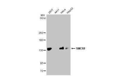 Western Blot: SMCR8 Antibody (HL1007) [NBP3-13677]