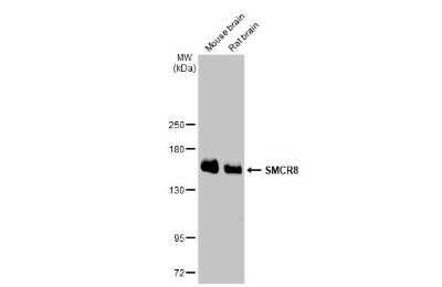 Western Blot: SMCR8 Antibody (HL1007) [NBP3-13677]