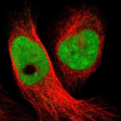 Immunocytochemistry/ Immunofluorescence: SMCR8 Antibody [NBP1-93833]