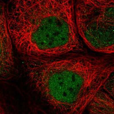 Immunocytochemistry/ Immunofluorescence: SMCR8 Antibody [NBP1-93834]