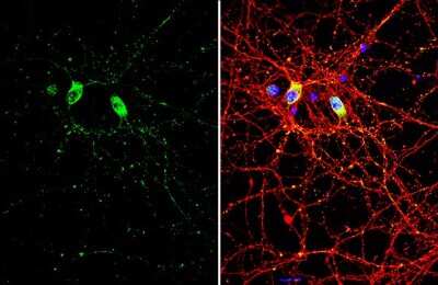 Immunocytochemistry/ Immunofluorescence: SMCR8 Antibody [NBP3-13411]